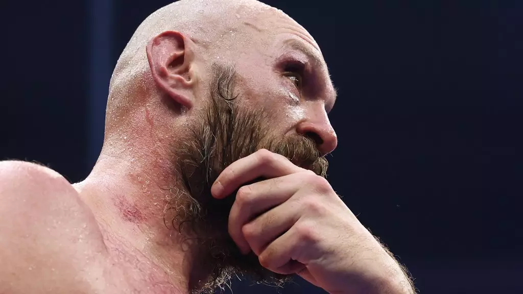 The Legacy of Tyson Fury: A Champion’s Journey Beyond Defeat