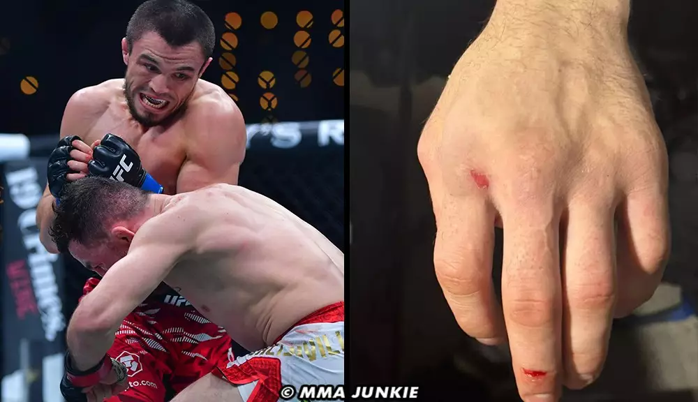 Injury Fallout from UFC 311: A Closer Look